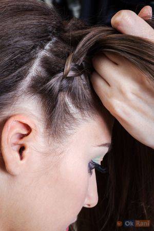 Traction Alopecia Hair Loss